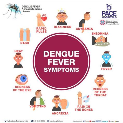 Dengue Fever .
